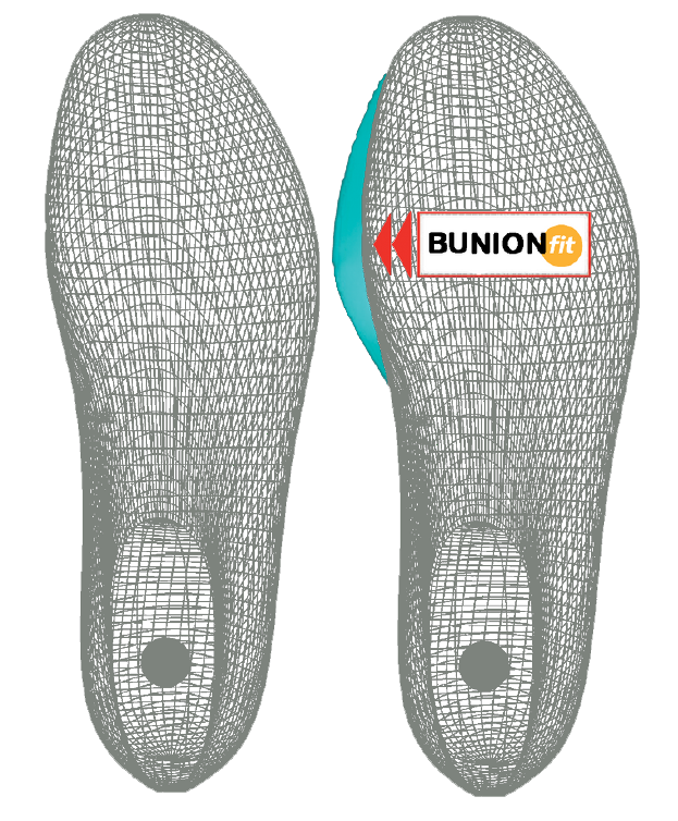 bunion-fit